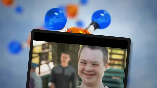 Video thumbnail for Anomalías cromosómicas: Causas, tipos y consecuencias