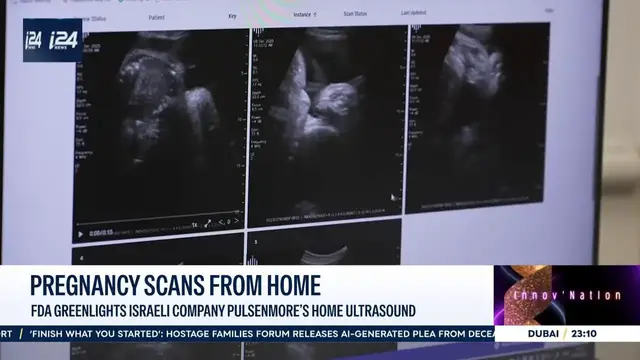 Video thumbnail for FDA approves Israeli company Pulsenmore's at-home ultrasound device in the US