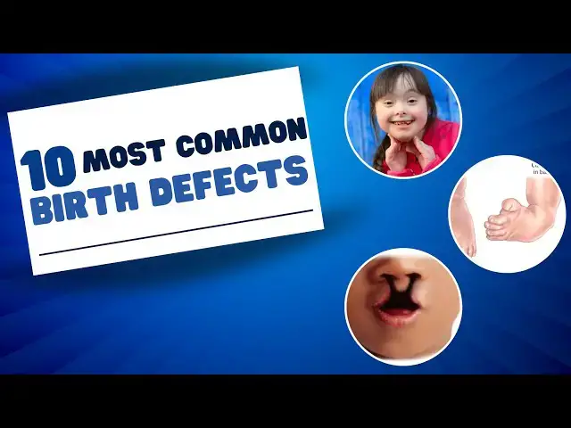 Video thumbnail for BIRTH DEFECTS 101