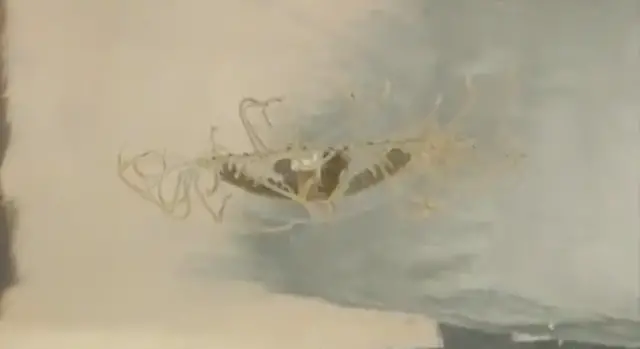 Video thumbnail for Six-year-old girl stung in Ocean County and hospitalized by invasive clinging jellyfish