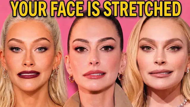 Video thumbnail for They Paid for a Face Lift. Now They Can't Move Their Smile