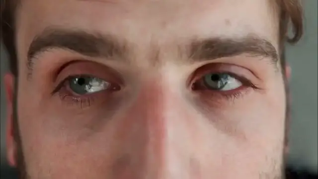 Video thumbnail for Eye Video 2024   #eyes