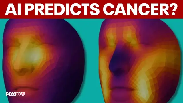 Video thumbnail for How AI can predict cancer survival from a single photo of a face