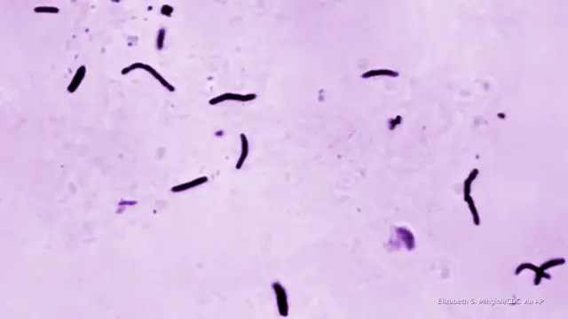 'Video thumbnail for TB is spreading in ICE detention centers. So what's the agency's responsibility?'