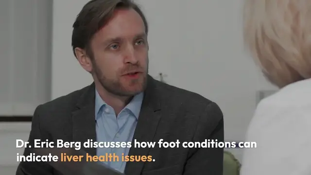 Video thumbnail for Foot Signs of Liver Health