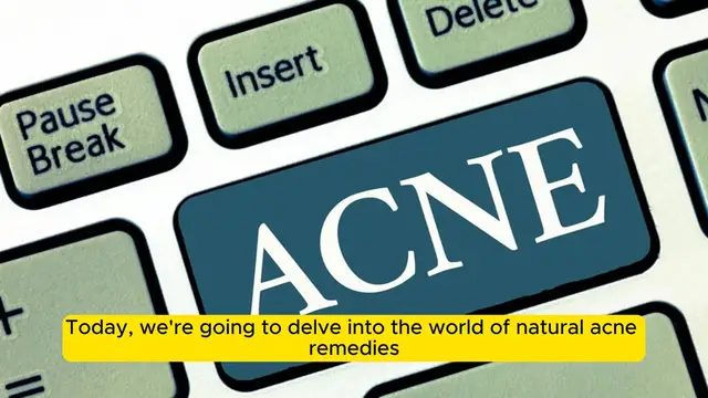 Video thumbnail for 7 Soothing Home Remedies for Acne