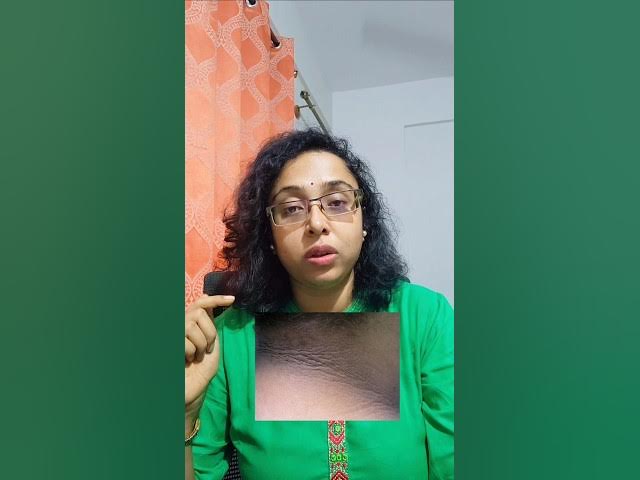 Video thumbnail for Common health problems due to nutrition deficiency in adults