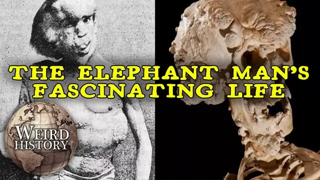 Video thumbnail for The Elephant Man | The Weird & Tragic Story of Joseph Merrick
