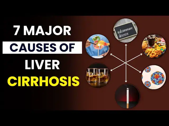 'Video thumbnail for 7 Major Causes of Liver Cirrhosis | Causes of Liver Cirrhosis | FitWise Daily'