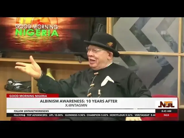 Video thumbnail for Albino Foundation Africa Is Commtited To Make Albinos Participate in All Areas Even in Politics |NTA