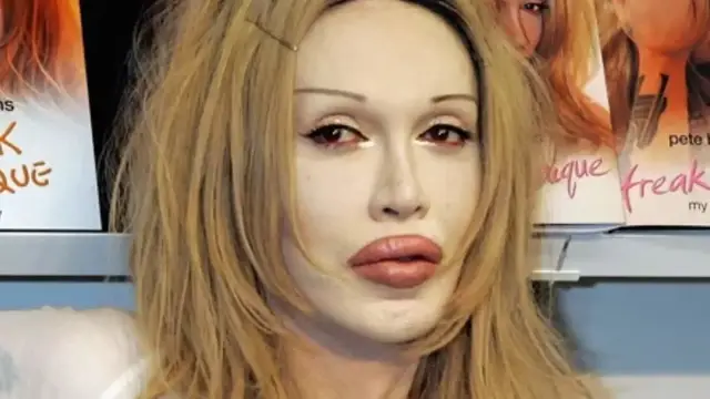 Video thumbnail for One-Hit Wonders You Didn't Realize Had Died