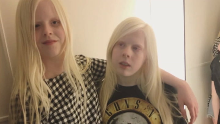 Video thumbnail for P249930YT BD AlbinismComp Youtube H264