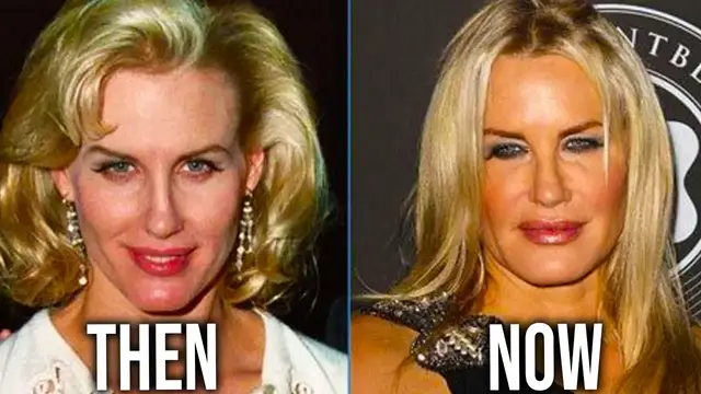 Video thumbnail for Top 10 Celebrities with TERRIBLE Plastic Surgery