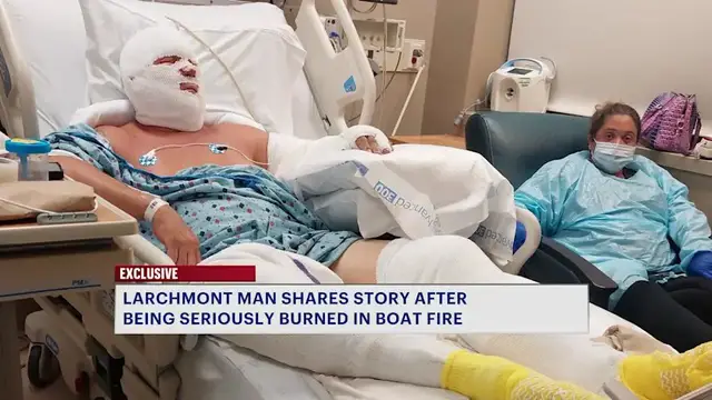 Video thumbnail for ‘I didn’t think I’d be here.’ Burn victim speaks out after Mamaroneck boat fire
