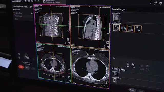 Video thumbnail for How AI and new tech are fighting the tri-state's deadliest cancer