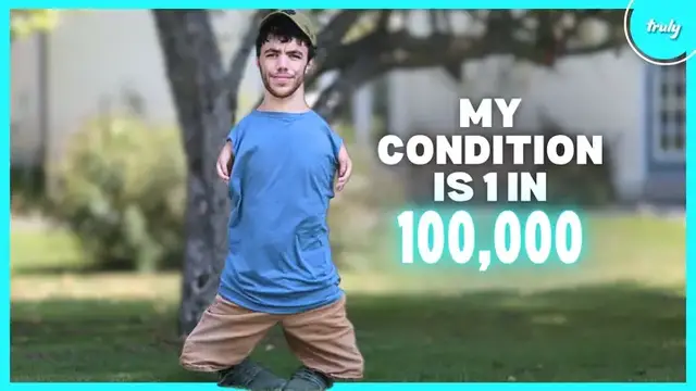 Video thumbnail for My Rare Limb Difference Made Me Go Viral | BORN DIFFERENT