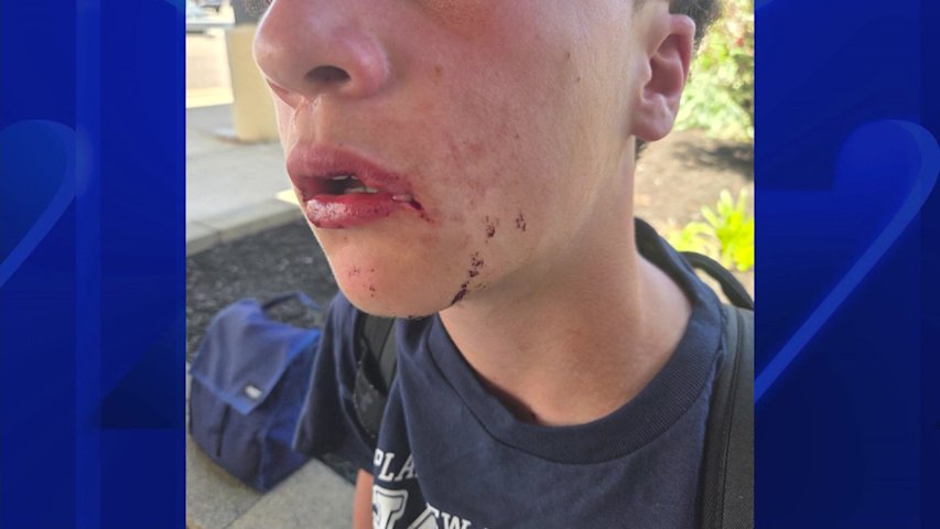 Video thumbnail for Mother seeks answers after she says her middle school student was attacked during recess