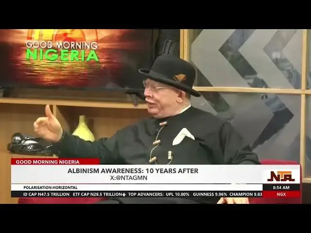 Video thumbnail for People With Albanism Are Ready and Capable To Serve | 5th July 2024 | NTA