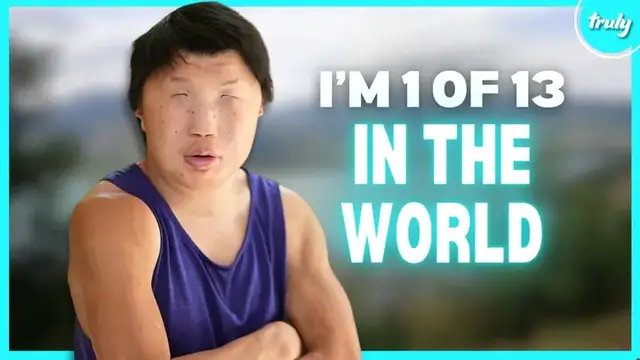 Video thumbnail for My Rare Condition Makes My Face Look Like A Mask | BORN DIFFERENT