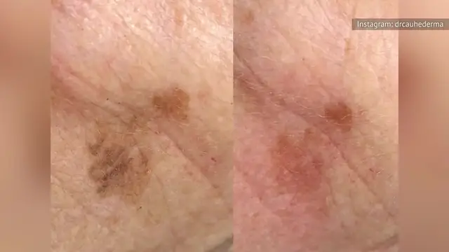 Video thumbnail for What Happens To Your Body When You Stop Showering?