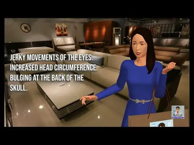 Video thumbnail for Dandy walker Syndrome