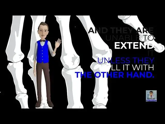 Video thumbnail for HAND PROBLEMS
