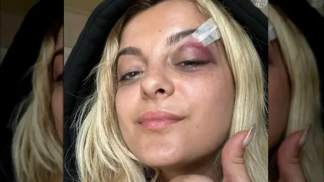 Video thumbnail for Times Fans Injured Musicians Onstage