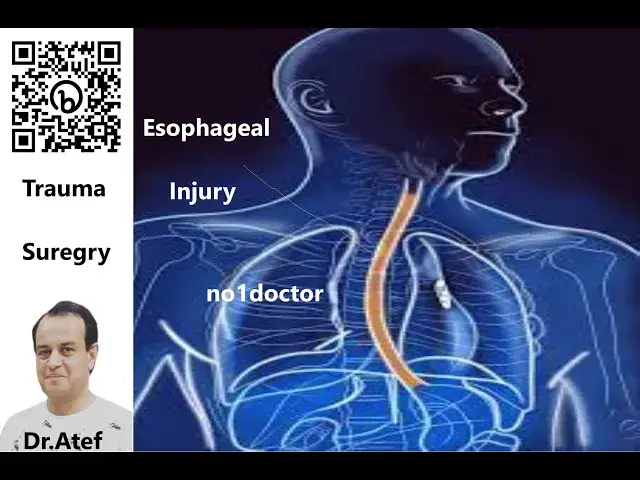 Video thumbnail for Esophageal Injury Trauma Questions and Answers#trauma #esophagus #esophageal #surgerytips #no1doctor