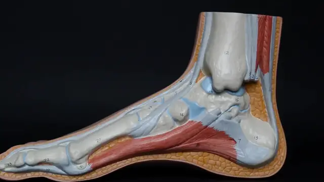 Video thumbnail for From Pain to Recovery: What You Need to Know About Achilles Tendon Ruptures and Healing