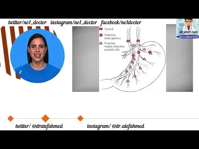 Video thumbnail for Vagotomy /Vagus Nerve /Indications /Types /Techniques /Lap vagotomy/Peptic ulcer / Complications