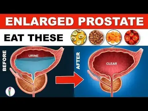 Video thumbnail for These Are The BEST and WORST Foods For Enlarged Prostate