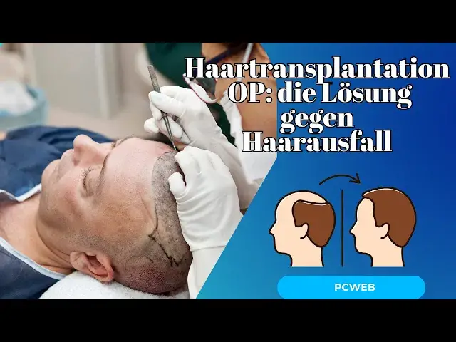 Video thumbnail for Haartransplantation OP: Die Lösung für dauerhaften Haarausfall