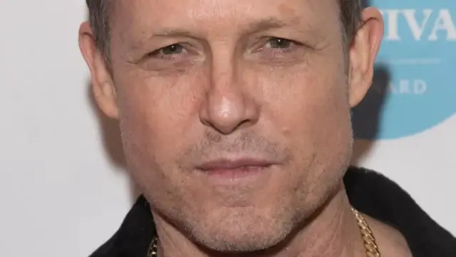 'Video thumbnail for Celebs You May Not Know Have Had Amputations'