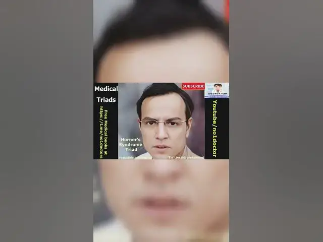 Video thumbnail for #horner_syndrome_triad #ptosis #myosis #anhydrosis #enophthamose #shorts #medical #usmle#frcs #mrcs