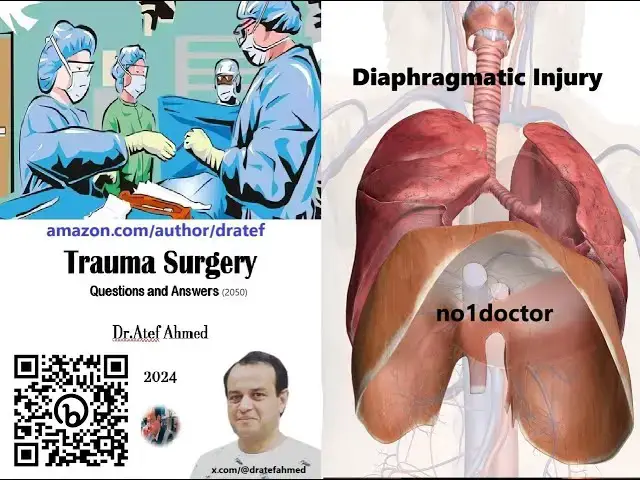 Video thumbnail for Diaphragmatic Injury  A Comprehensive Guide for Medical Professionals #diaphragmaticinjury #medicine
