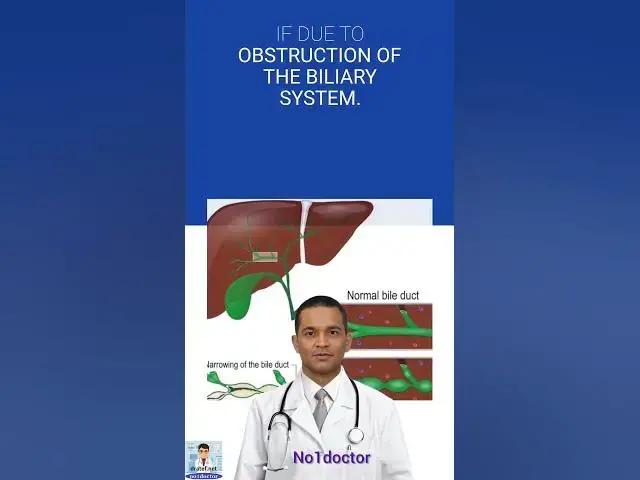Video thumbnail for Cholangitis #shorts #liver #gallstones #gallbladder  #cholangitis #biliary  #no1doctor #infection