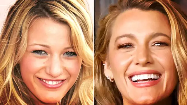 'Video thumbnail for Celebs Who Only Hit The Big Time After Plastic Surgery'