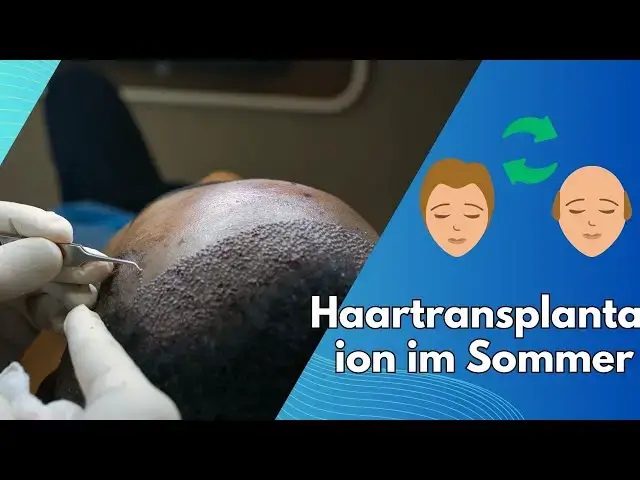 Video thumbnail for Haartransplantation im Sommer