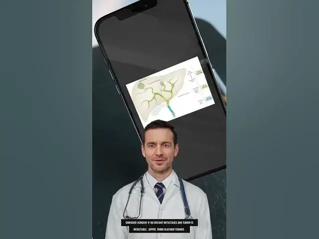 Video thumbnail for #Bile Duct cancer #cholangiocarcinoma   #shorts #biliary #duct #bile #gallbladder #cancer #tumor