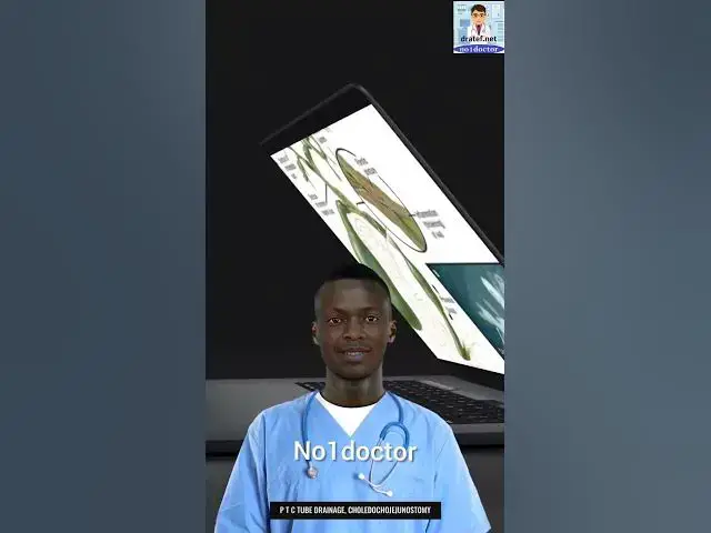 Video thumbnail for Primary sclerosing cholangitis #shorts #liver #gallstones #gallbladder  #cholangitis#biliary#dratef