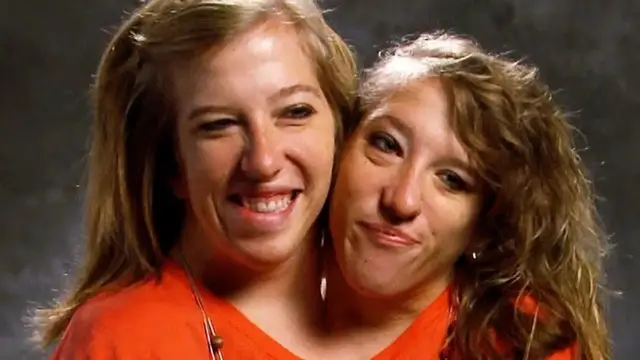 'Video thumbnail for What You Don't Know About These Famous Twins'