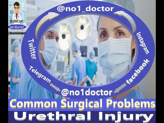 Video thumbnail for Urtheral Injury/Surgical Problems/Management of Urtheral Trauma /No1doctor /dratef /Mrcs /Frcs/Usmle