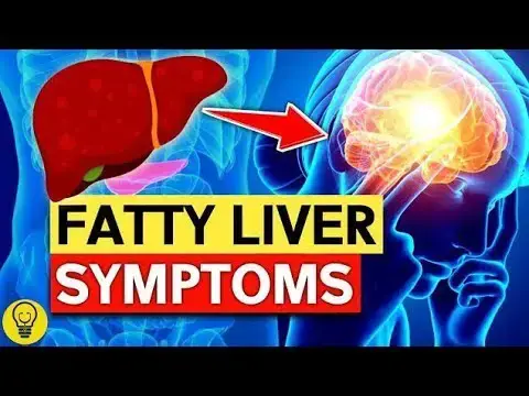 Video thumbnail for EAT THESE 15 SUPER Foods To Prevent & Reverse FATTY LIVER!