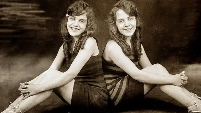 'Video thumbnail for The Untold Truth Of The Conjoined Hilton Sisters'