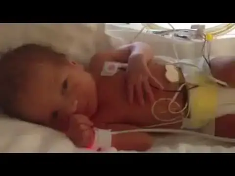 'Video thumbnail for Angel bebe prematuro'
