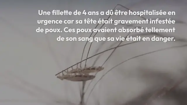 Video thumbnail for Une fillette de 4 ans gravement infectée par des poux a failli mourir