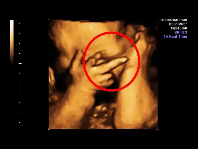 Video thumbnail for Mom Thinks She’s Pregnant With Twins, Doctor Freezes When He Sees Her Ultrasound
