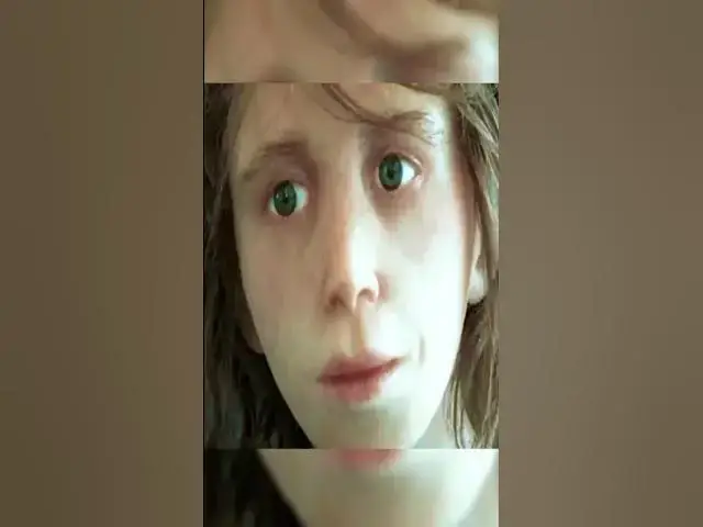'Video thumbnail for Scientists Discover Girl Born From Two Different Species'