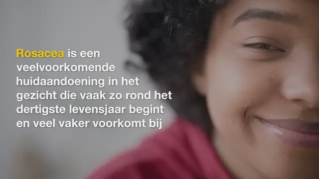 Video thumbnail for Rosacea, mamsatwork lezeressen testten Gladskin Rosacea