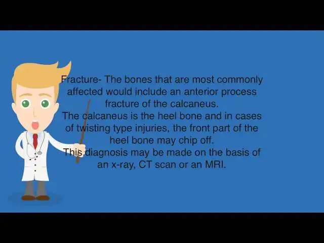 Video thumbnail for Lateral Column Pain